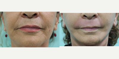 before and after image
