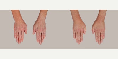 before and after image