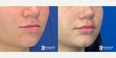 before and after image