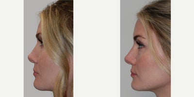 before and after image