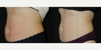 before and after image