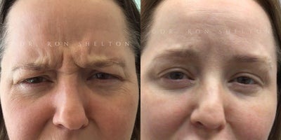 before and after image