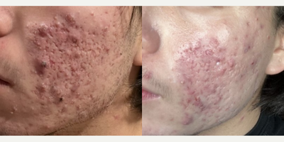 before and after image