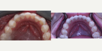 before and after image