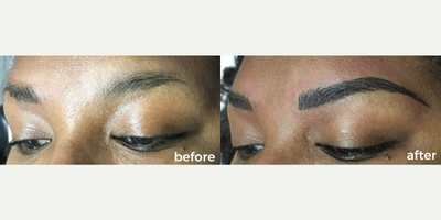 Permanent Makeup before and after photo