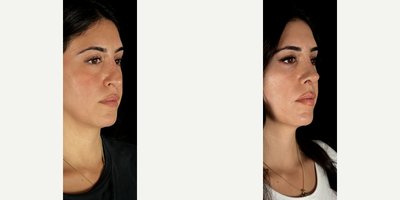 before and after image