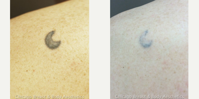 before and after image