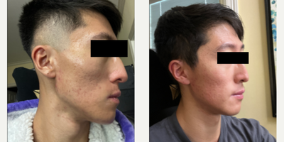 before and after image