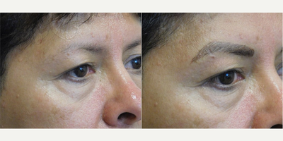 Microblading before and after photo