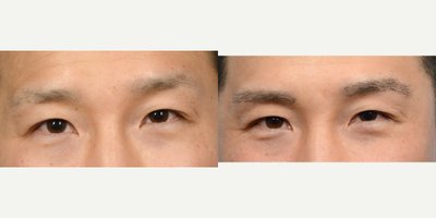 before and after image