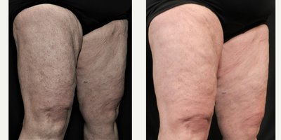 before and after image