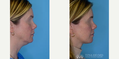 before and after image
