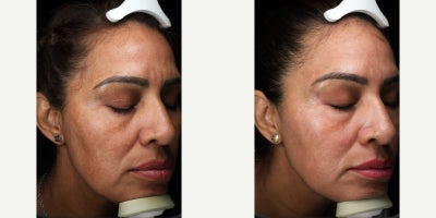 before and after image