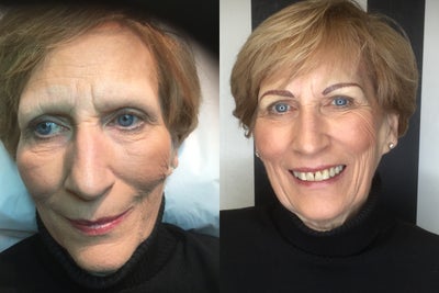 Permanent Makeup before and after photo