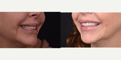 before and after image