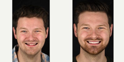 before and after image