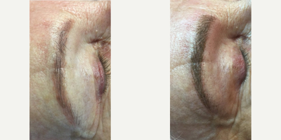 before and after image
