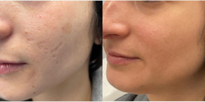 before and after image