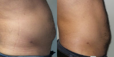 before and after image