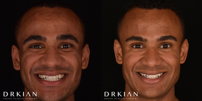 before and after image