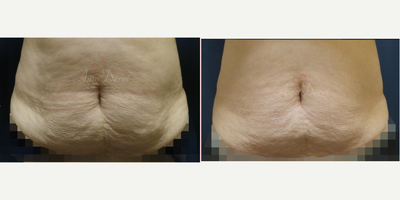 before and after image