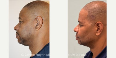 before and after image