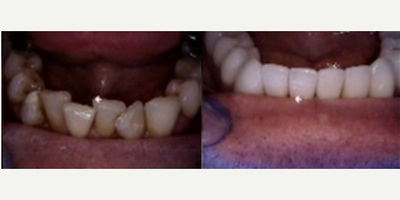 before and after image