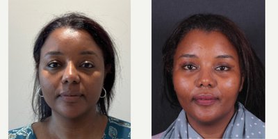 before and after image