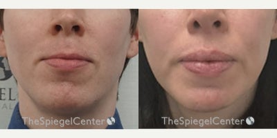 before and after image