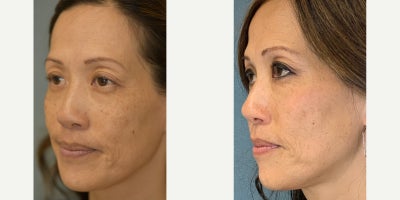 before and after image