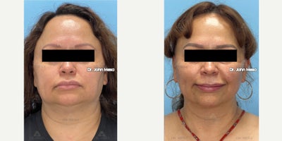 before and after image