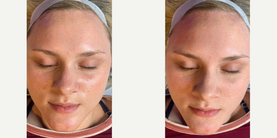 before and after image