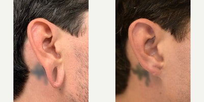 before and after image