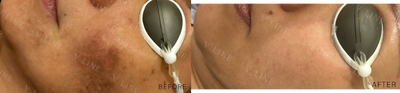 before and after image