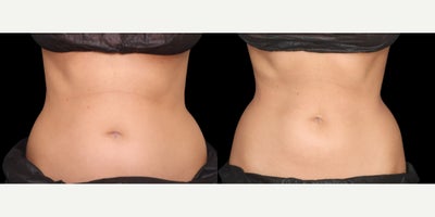 before and after image