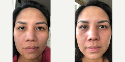 Clear and Brilliant before and after photo