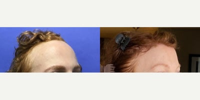 before and after image