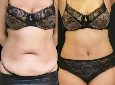 before and after image