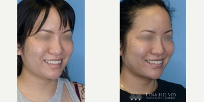 before and after image