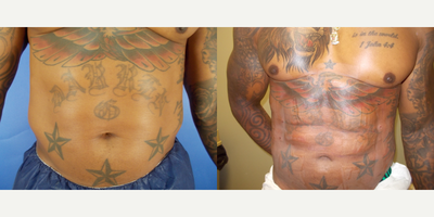 before and after image