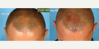 before and after image
