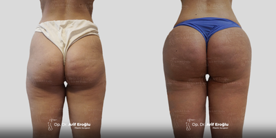before and after image
