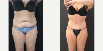 before and after image
