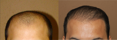 before and after image
