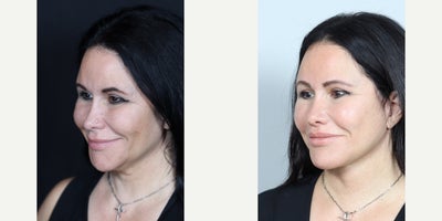 before and after image