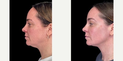 before and after image