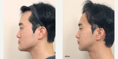 before and after image