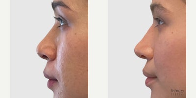 before and after image