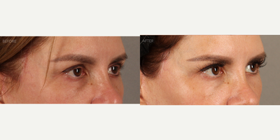 before and after image