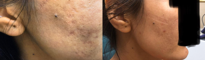 before and after image
